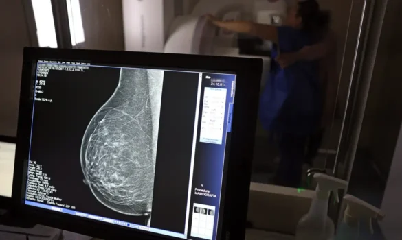 Mamografia – José Cruz-Agência Brasil